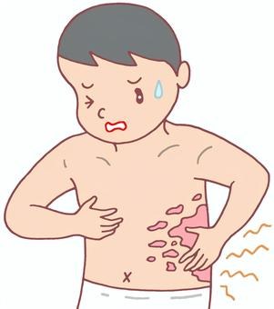 배와 옆구리에 발진이 올라와 가려워하는 아이 일러스트