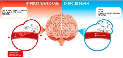 Ahlskog JE et al. Physical exercise as a preventive or disease-modifying treatment of dementia and brainaging. Mayo Clinic Proceedings. 2011